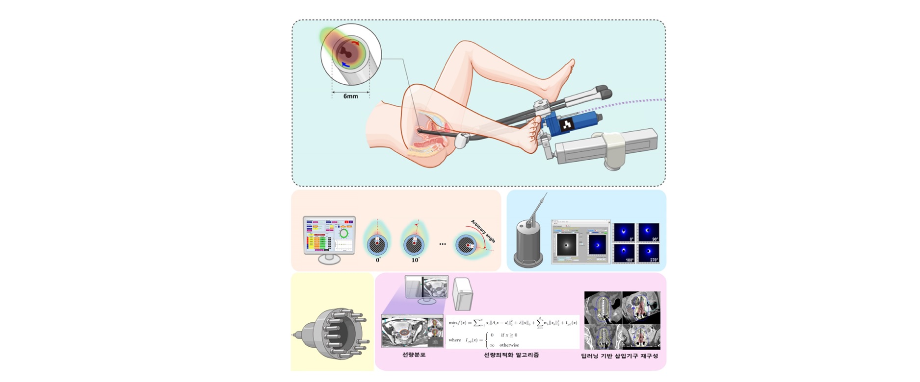 자궁암 치료용 체내삽입기구 및 제반시스템 대표 이미지